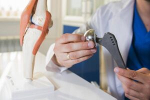 MPClinic у Києві пропонує сучасні рішення та індивідуальний підхід до ендопротезування, використовуючи новітні матеріали і технології для успішного відновлення пацієнтів.